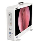 Camjoy CF916 Taşınabilir 15.6 FHD Endoskopik Kamera Sistemi Hepsi Bir Arada KBB Ünitesi FHD 03