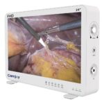 Camjoy CF924 24 Entegre FHD Endoskopi Kamera Sistemi Tıbbi Görüntüleme Merkezi FHD 01