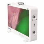 Camjoy CG932 32 inç 4K-ICG FPGA Endoskop Kamera Sistemi 02